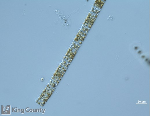 Photo of Cerataulina pelagica